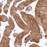 LMOD3 Antibody in Immunohistochemistry (Paraffin) (IHC (P))