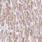LMOD3 Antibody in Immunohistochemistry (Paraffin) (IHC (P))