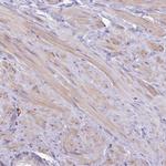 LMOD3 Antibody in Immunohistochemistry (Paraffin) (IHC (P))