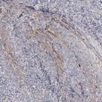 ADCK2 Polyclonal Antibody