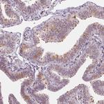 LRRC48 Antibody in Immunohistochemistry (Paraffin) (IHC (P))
