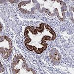 VWDE Polyclonal Antibody