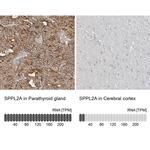 SPPL2A Polyclonal Antibody