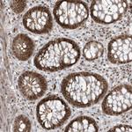 CA052 Antibody in Immunohistochemistry (Paraffin) (IHC (P))