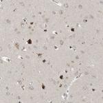 SLC35A2 Polyclonal Antibody