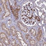 Tensin 1 Polyclonal Antibody