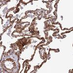 Tensin 1 Antibody in Immunohistochemistry (IHC)