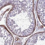 Tensin 1 Antibody in Immunohistochemistry (IHC)