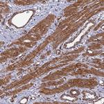 Tensin 1 Polyclonal Antibody