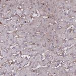 Tensin 1 Antibody in Immunohistochemistry (IHC)