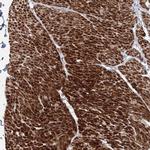 FAM155B Antibody in Immunohistochemistry (Paraffin) (IHC (P))
