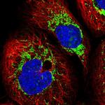 KCTD6 Polyclonal Antibody