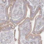 KCTD6 Antibody in Immunohistochemistry (Paraffin) (IHC (P))