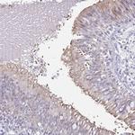 FAM162B Polyclonal Antibody