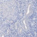 SHCBP1L Antibody in Immunohistochemistry (IHC)