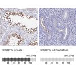 SHCBP1L Antibody in Immunohistochemistry (IHC)