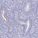 SHCBP1L Antibody in Immunohistochemistry (IHC)
