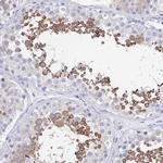 SHCBP1L Antibody in Immunohistochemistry (IHC)