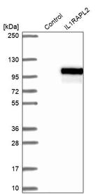 IL1RAPL2 Antibody in Western Blot (WB)