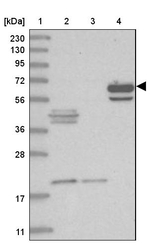 ASNSD1 Antibody in Western Blot (WB)