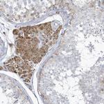 VPRBP Polyclonal Antibody