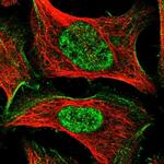 TAS2R42 Polyclonal Antibody