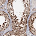 TAS2R42 Antibody in Immunohistochemistry (Paraffin) (IHC (P))