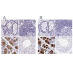PRR27 Antibody in Immunohistochemistry (IHC)