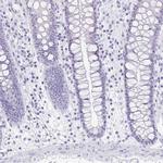 PRR27 Antibody in Immunohistochemistry (IHC)