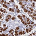 PRR27 Antibody in Immunohistochemistry (IHC)