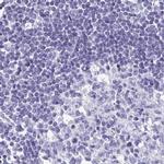 PRR27 Antibody in Immunohistochemistry (IHC)