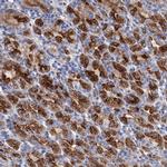 GPR155 Polyclonal Antibody