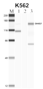 DHX57 Antibody in RNA Immunoprecipitation (RIP)