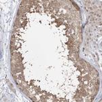 DHX57 Antibody in Immunohistochemistry (Paraffin) (IHC (P))