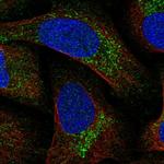 MITD1 Polyclonal Antibody