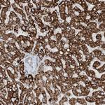 MITD1 Antibody in Immunohistochemistry (Paraffin) (IHC (P))