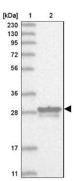 MITD1 Antibody in Western Blot (WB)