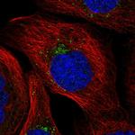 MITD1 Polyclonal Antibody