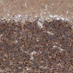 FAM126B Antibody in Immunohistochemistry (IHC)