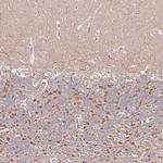 FAM126B Polyclonal Antibody