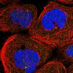 ANKAR Polyclonal Antibody