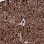 ANKAR Antibody in Immunohistochemistry (Paraffin) (IHC (P))