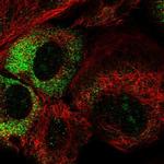 THUMPD3 Polyclonal Antibody