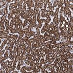 THUMPD3 Antibody in Immunohistochemistry (Paraffin) (IHC (P))