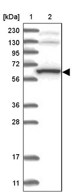 THUMPD3 Antibody in Western Blot (WB)