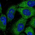 THUMPD3 Antibody in Immunocytochemistry (ICC/IF)