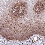 THUMPD3 Antibody in Immunohistochemistry (IHC)