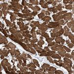 ZNF654 Polyclonal Antibody