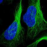 ZNF654 Polyclonal Antibody