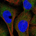 UMPS Polyclonal Antibody